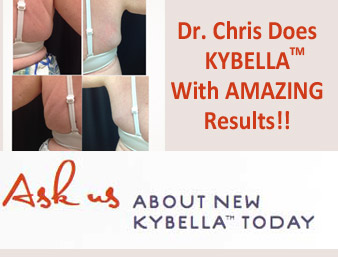 featured-kybella-special