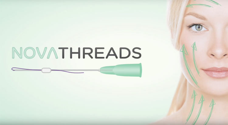 Winston Salem Dermatology & Surgery Center is excited to now offer NovaThreads PDO Thread Lift – A Nonsurgical Facelift Using NovaThreads!