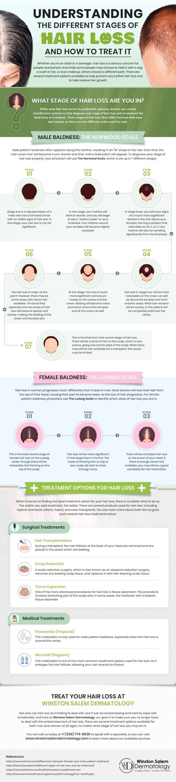 Understanding the Different Stages of Hair Loss