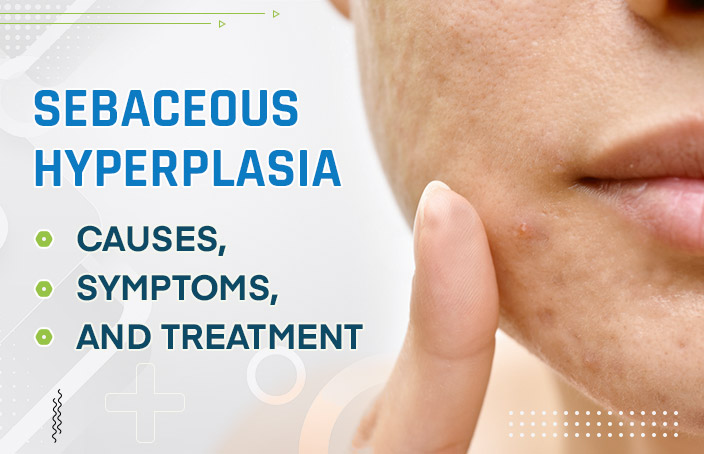 Sebaceous-Hyperplasia--Causes,-Symptoms,-and-Treatment