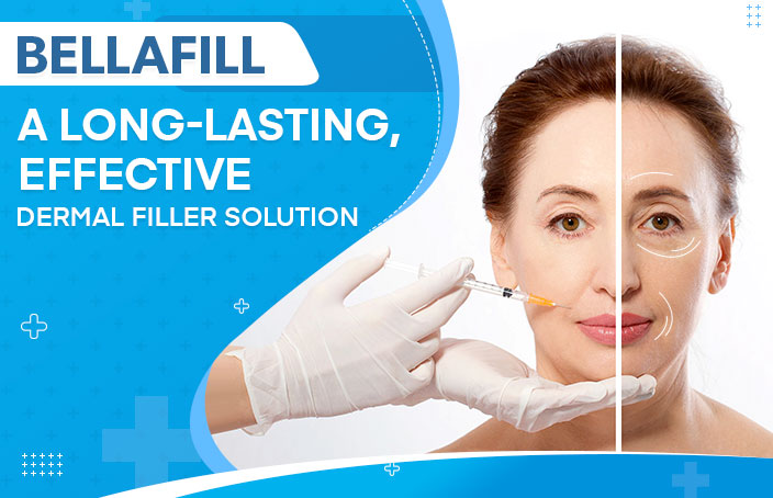 Bellafill A Long-Lasting, Effective Dermal Filler Solution