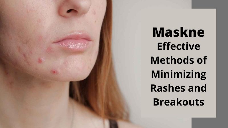 Maskne: Effective Methods of Minimizing Rashes and Breakouts