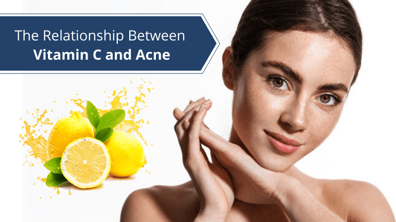 The Relationship Between Vitamin C and Acne
