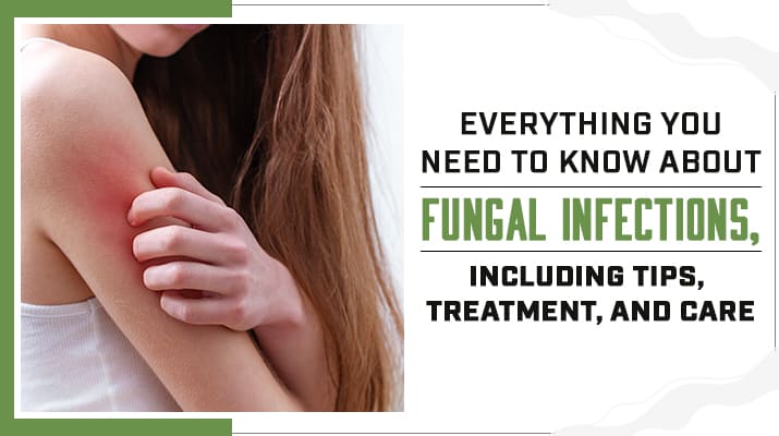 Everything You Need to Know About Fungal Infections, Including Tips, Treatment, and Care