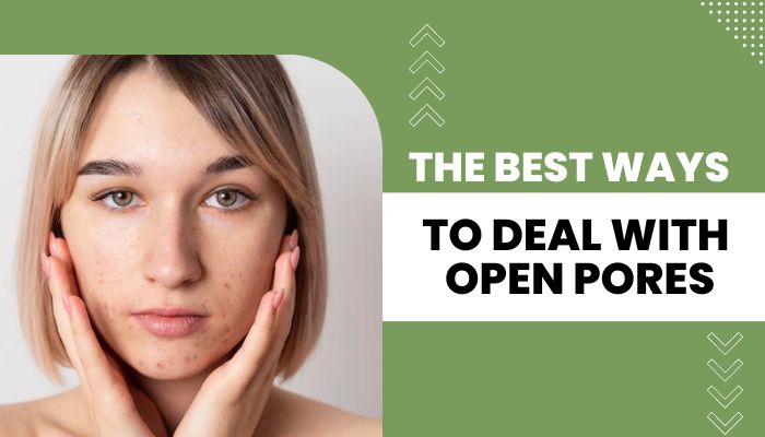The Best Ways to Deal with Open Pores