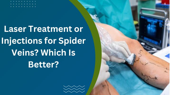 Laser Treatment or Injections for Spider Veins Which Is Better