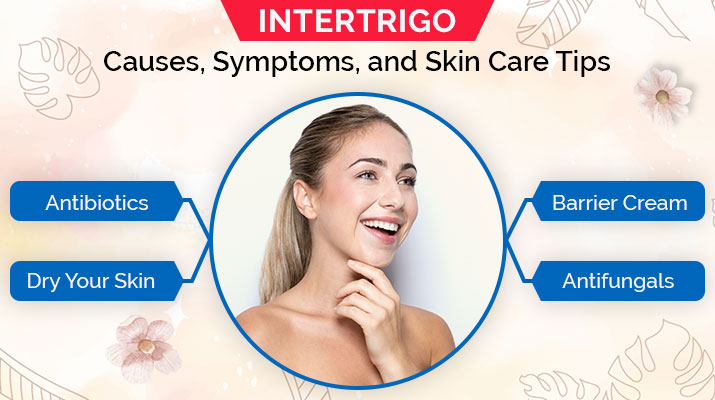 Intertrigo-Causes,-Symptoms,-and-Skin-Care-Tips